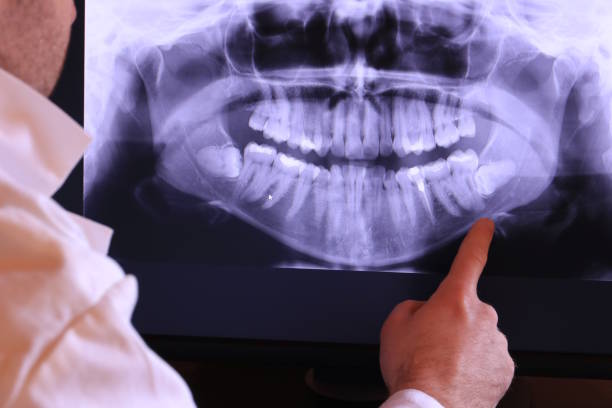 Best Emergency Root Canal Treatment in Scanlon, MN